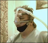 Nasal mask and chin strap. Stops mouth falling open while asleep